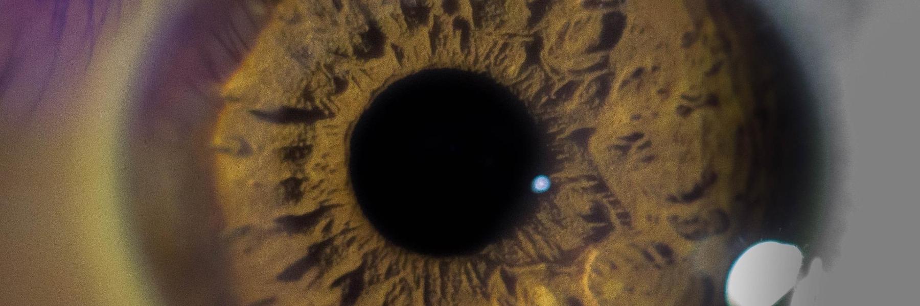 Close Up of Eye | Optometrist Gold Coast