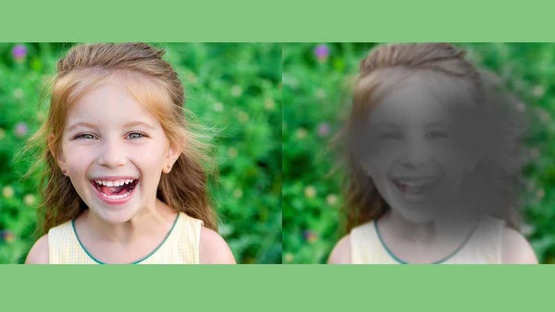 Macular Degeneration Tweed Heads Envision Optical